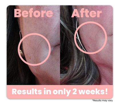 Light Therapy Beauty Device